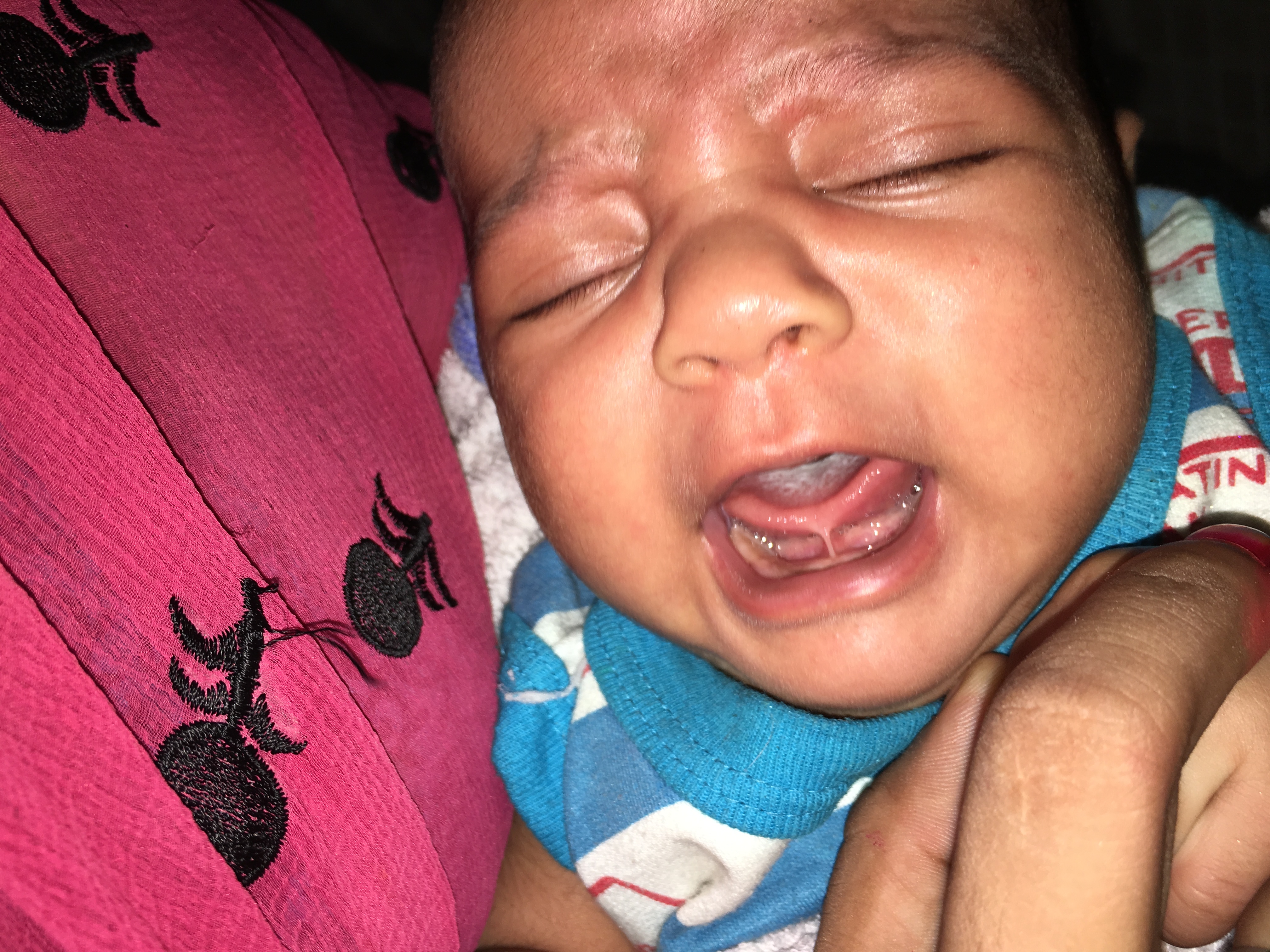 Pediatric General Surgery Image 4